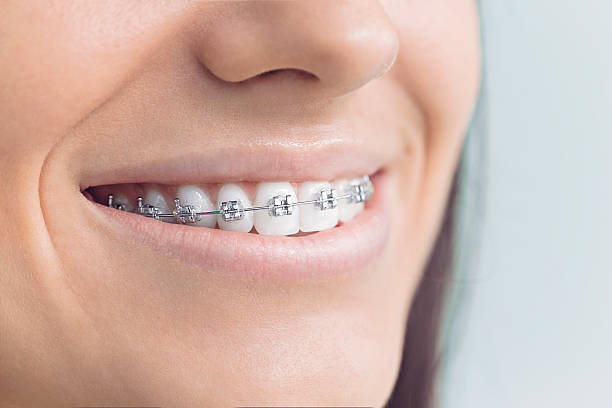 Best Teeth Whitening  in Grant, AL
